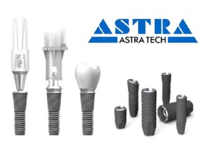 Швейцарский имплант (Astra Tech )